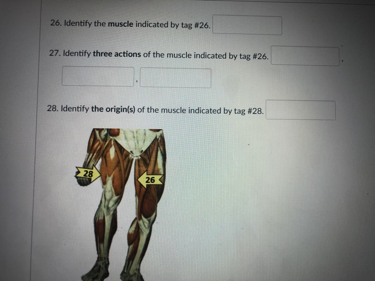 26. Identify the muscle indicated by tag #26.
27. Identify three actions of the muscle indicated by tag #26.
28. Identify the origin(s) of the muscle indicated by tag #28.
2 28
26
