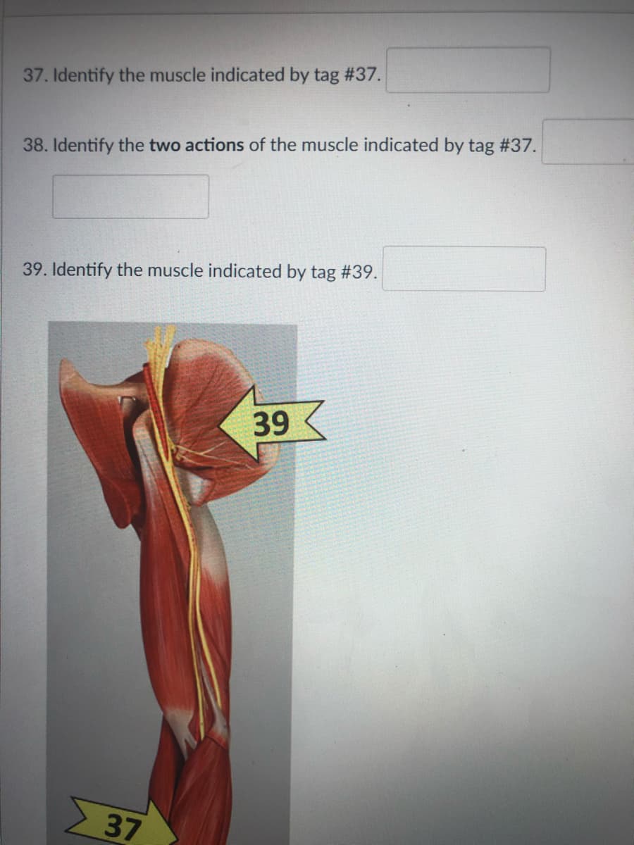 37. Identify the muscle indicated by tag #37.
38. Identify the two actions of the muscle indicated by tag #37.
39. Identify the muscle indicated by tag #39.
39
37
