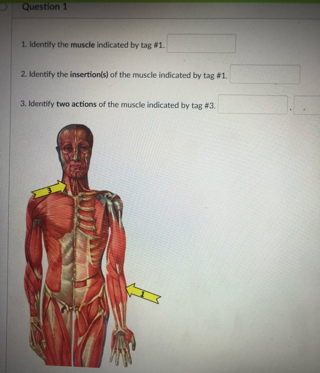 Question 1
1. Identify the muscle indicated by tag # 1.
2. Identify the insertion(s) of the muscle indicated by tag #1.
3. Identify two actions of the muscle indicated by tag #3.
