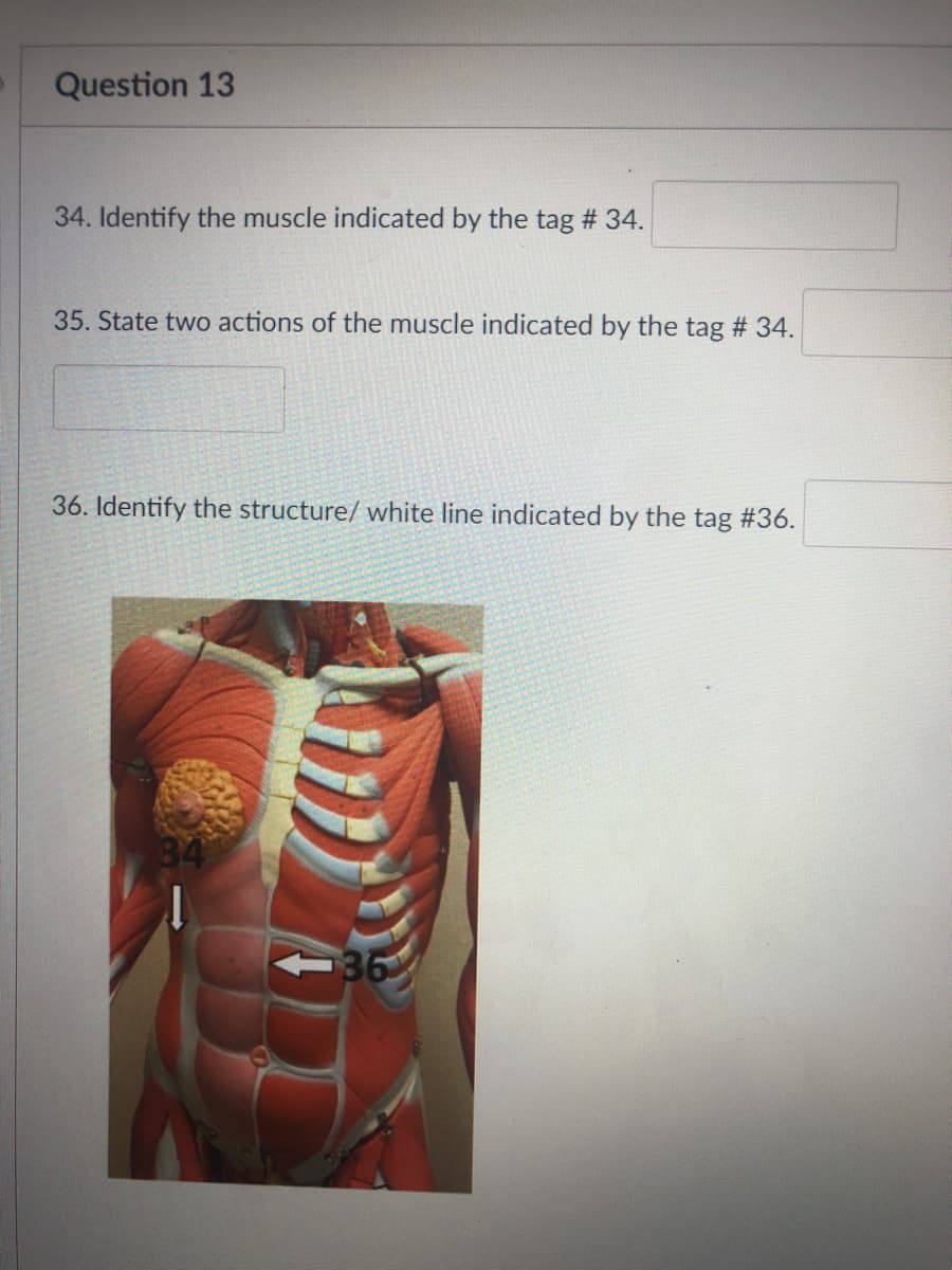 Question 13
34. Identify the muscle indicated by the tag # 34.
35. State two actions of the muscle indicated by the tag # 34.
36. Identify the structure/ white line indicated by the tag #36.
