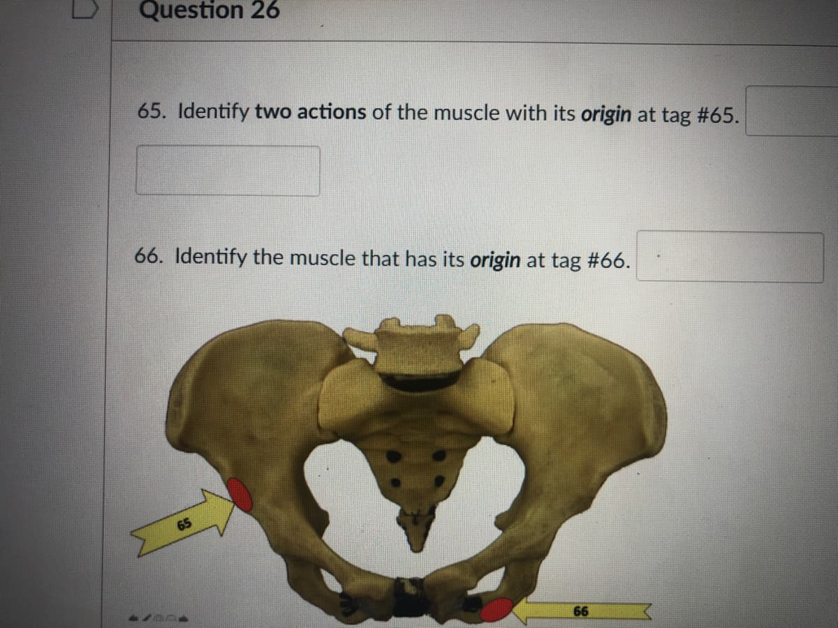 Question 26
65. Identify two actions of the muscle with its origin at tag #65.
66. Identify the muscle that has its origin at tag #66.
65
66
