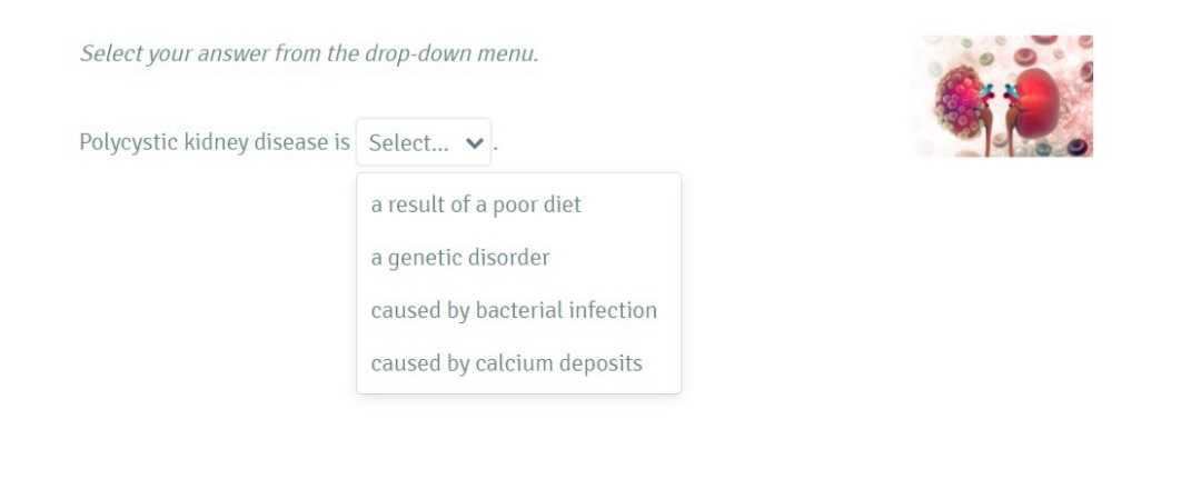 Select your answer from the drop-down menu.
Polycystic kidney disease is Select... v
a result of a poor diet
a genetic disorder
caused by bacterial infection
caused by calcium deposits
