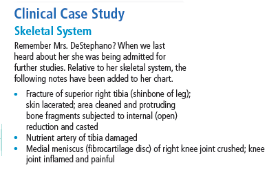 Clinical Case Study
Skeletal System
Remember Mrs. DeStephano? When we last
heard about her she was being admitted for
further studies. Relative to her skeletal system, the
following notes have been added to her chart.
• Fracture of superior right tibia (shinbone of leg);
skin lacerated; area cleaned and protruding
bone fragments subjected to internal (open)
reduction and casted
Nutrient artery of tibia damaged
Medial meniscus (fibrocartilage disc) of right knee joint crushed; knee
joint inflamed and painful
