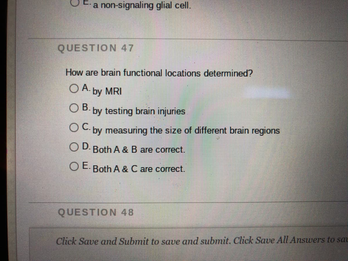 a non-signaling glial cell.
QUESTION 47
How are brain functional locations determined?
O A. by MRI
O B. by testing brain injuries
OC by measuring the size of different brain regions
O D. Both A & B are correct.
OE Both A & C are correct.
QUESTION 48
Click Save and Submit to save and submit. Click Save All Answers to sau
