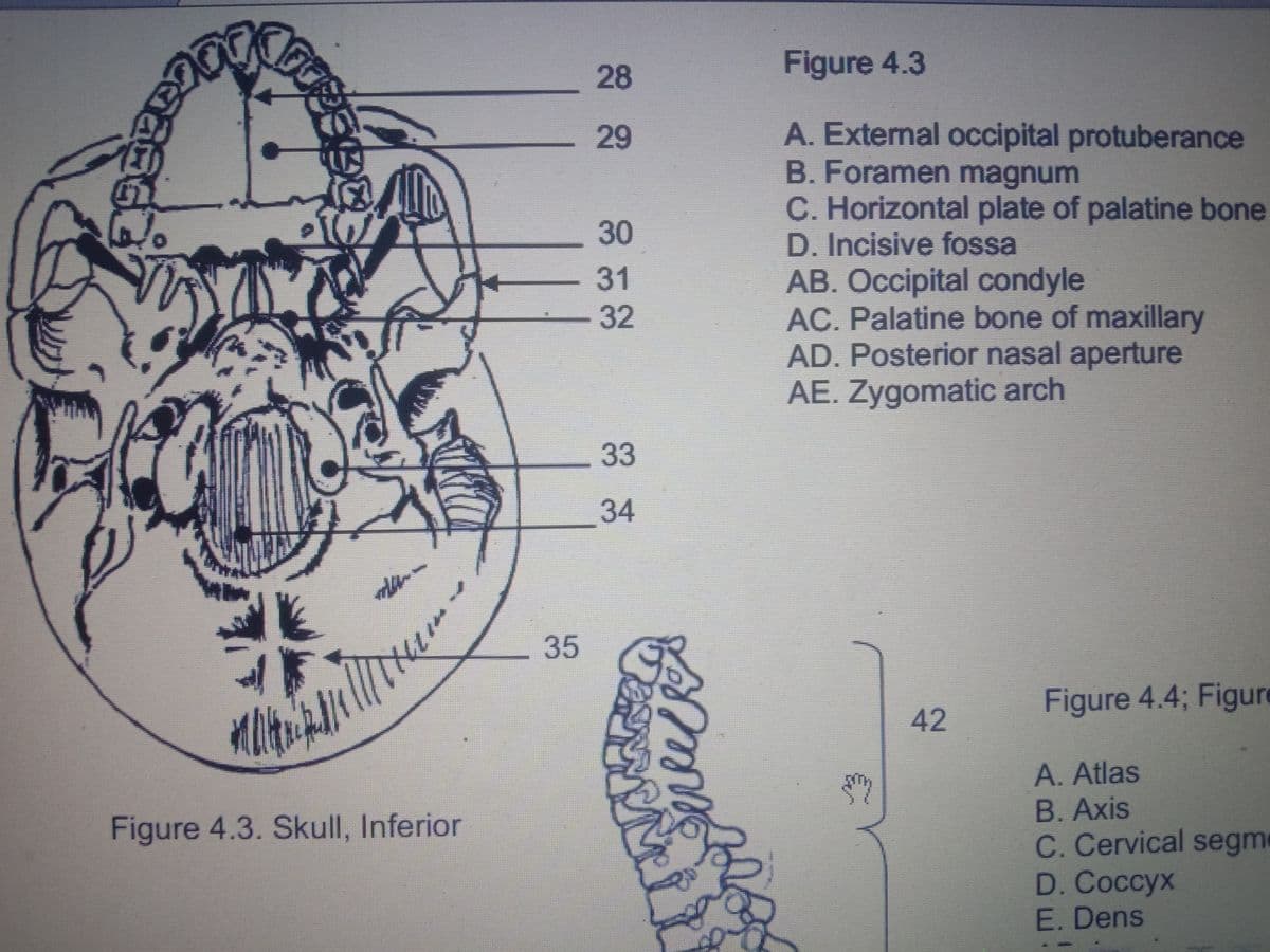 28
Figure 4.3
A. External occipital protuberance
B. Foramen magnum
C. Horizontal plate of palatine bone
D. Incisive fossa
AB. Occipital condyle
AC. Palatine bone of maxillary
AD. Posterior nasal aperture
AE. Żygomatic arch
29
30
31
32
33
34
35
Figure 4.4; Figue
42
A.Atlas
B. Axis
C. Cervical segm
D. Coccyx
E. Dens
Figure 4.3. Skull, Inferior
