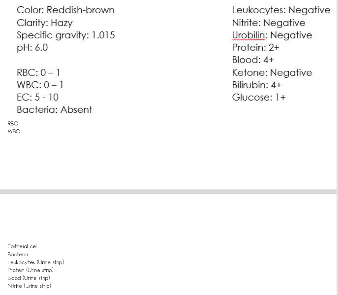 Color: Reddish-brown
Clarity: Hazy
Specific gravity: 1.015
pH: 6.0
Leukocytes: Negative
Nitrite: Negative
Urobilin: Negative
Protein: 2+
Blood: 4+
RBC: 0 - 1
Ketone: Negative
WBC: 0 - 1
ЕС: 5- 10
Bilirubin: 4+
Glucose: 1+
Bacteria: Absent
RBC
WBC
Epithelial cell
Bacteria
Leukocytes (Urine strip)
Protein (Urine strip)
Blood (Urine strip)
Nitrite (Urine strip)
