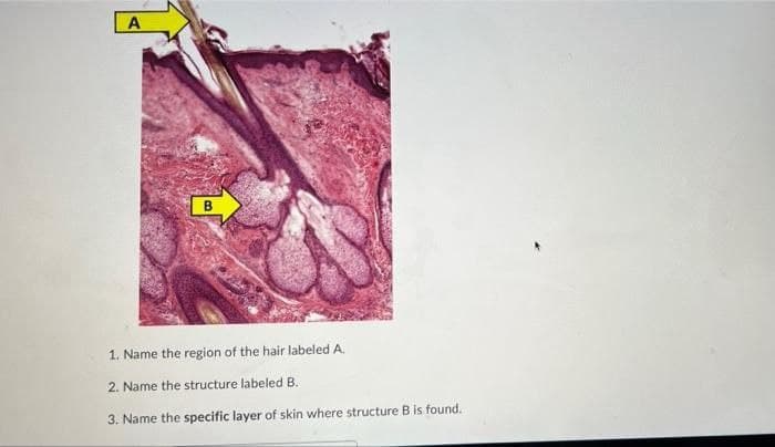 B
1. Name the region of the hair labeled A.
2. Name the structure labeled B.
3. Name the specific layer of skin where structure B is found.
