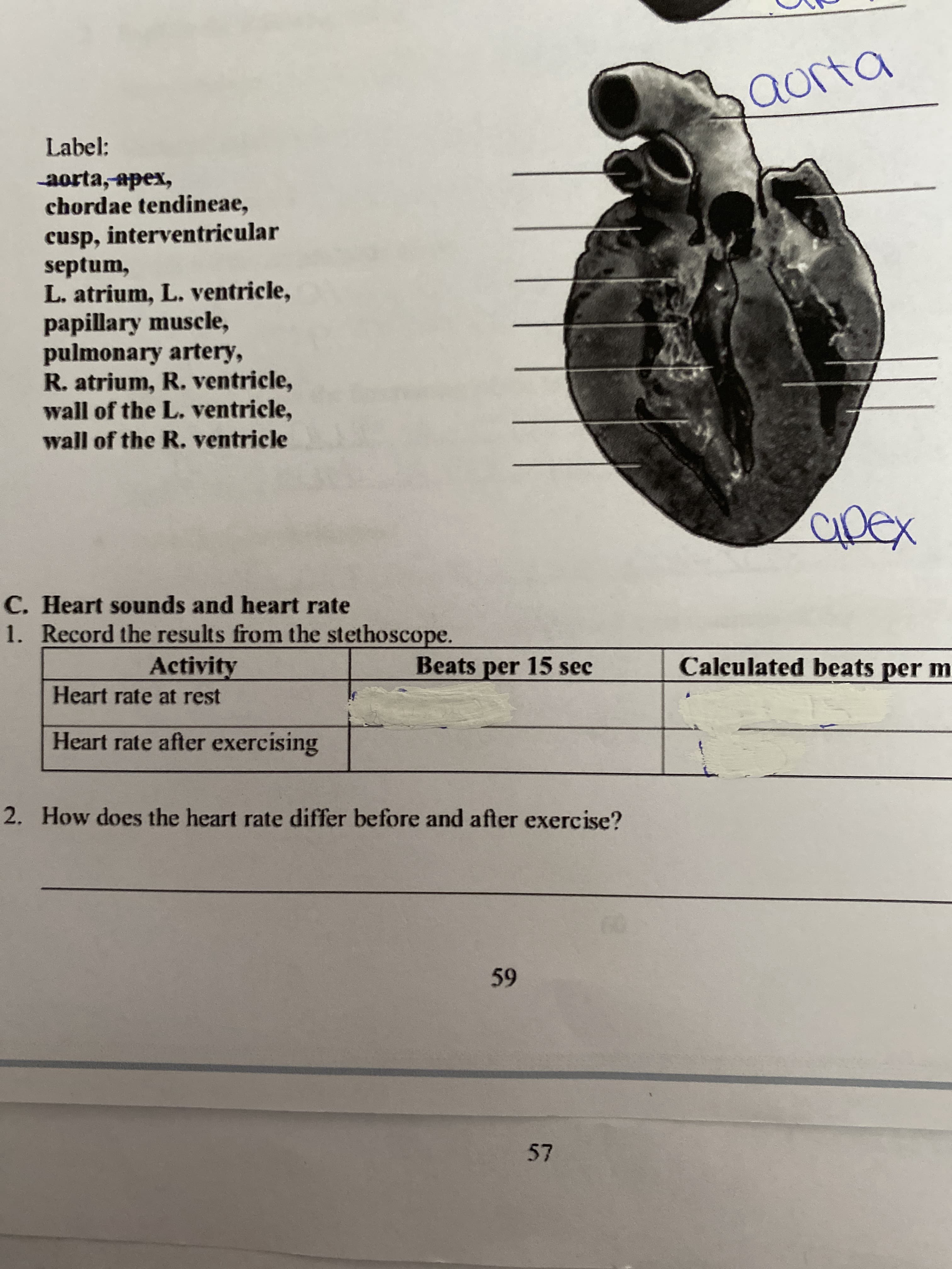 Label:
aorta,apex,
chordae tendineae,
cusp, interventricular
septum,
L. atrium, L. ventricle,
papillary muscle,
pulmonary artery,
R. atrium, R. ventricle,
wall of the L. ventricle,
wall of the R. ventricle
