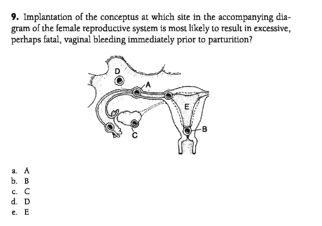 9. Implantation of the conceptus at which site in the accompanying dia-
gram of the female reproductive system is most likely to result in excessive,
perhaps fatal, vaginal bleeding immediately prior to parturition?
-B
а. А
b. В
С. С
d. D
е. Е
