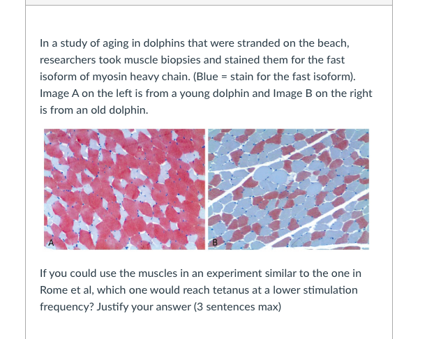 In a study of aging in dolphins that were stranded on the beach,
researchers took muscle biopsies and stained them for the fast
isoform of myosin heavy chain. (Blue = stain for the fast isoform).
Image A on the left is from a young dolphin and Image B on the right
is from an old dolphin.
If you could use the muscles in an experiment similar to the one in
Rome et al, which one would reach tetanus at a lower stimulation
frequency? Justify your answer (3 sentences max)
