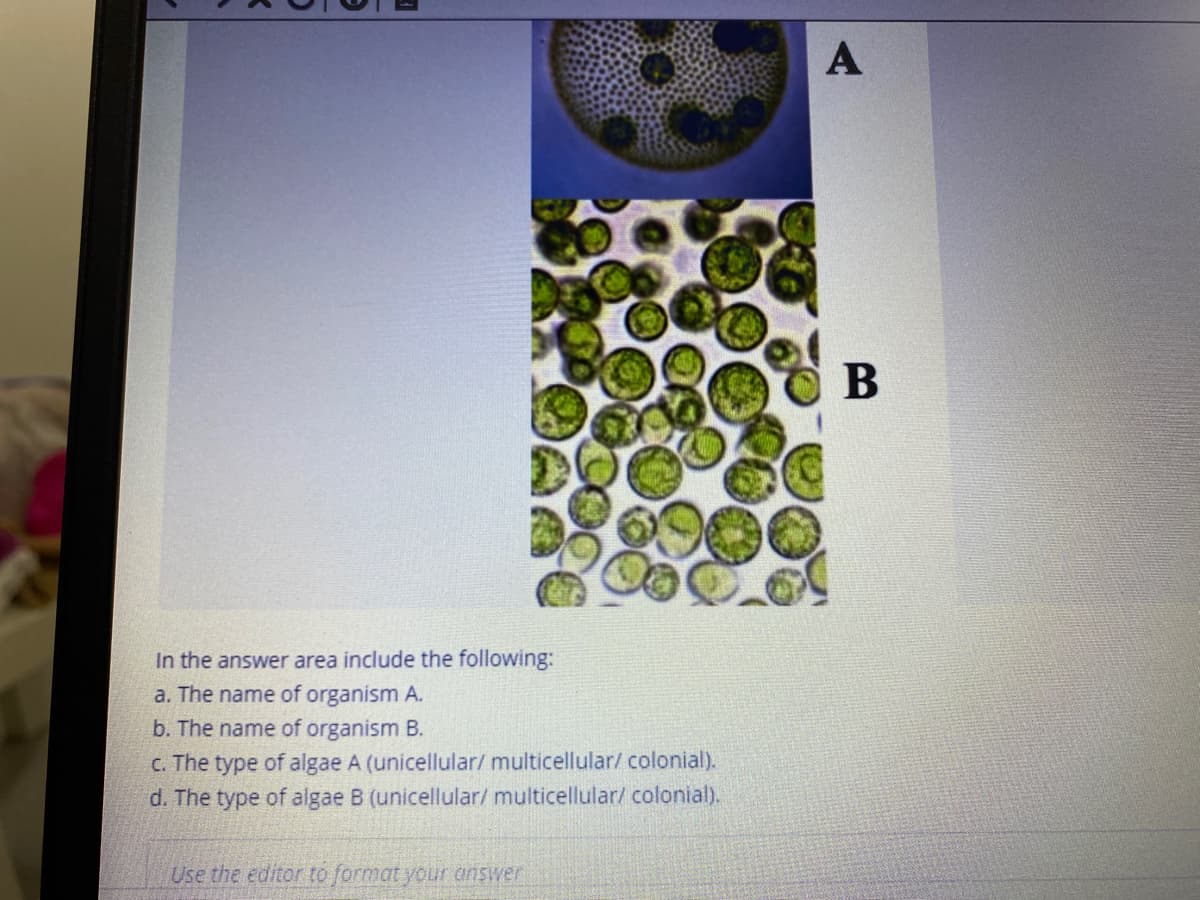 A
In the answer area include the following:
a. The name of organism A.
b. The name of organism B.
C. The type of algae A (unicellular/ multicellular/ colonial).
d. The type of algae B (unicellular/ multicellular/ colonial).
Use the editor to format your answer
