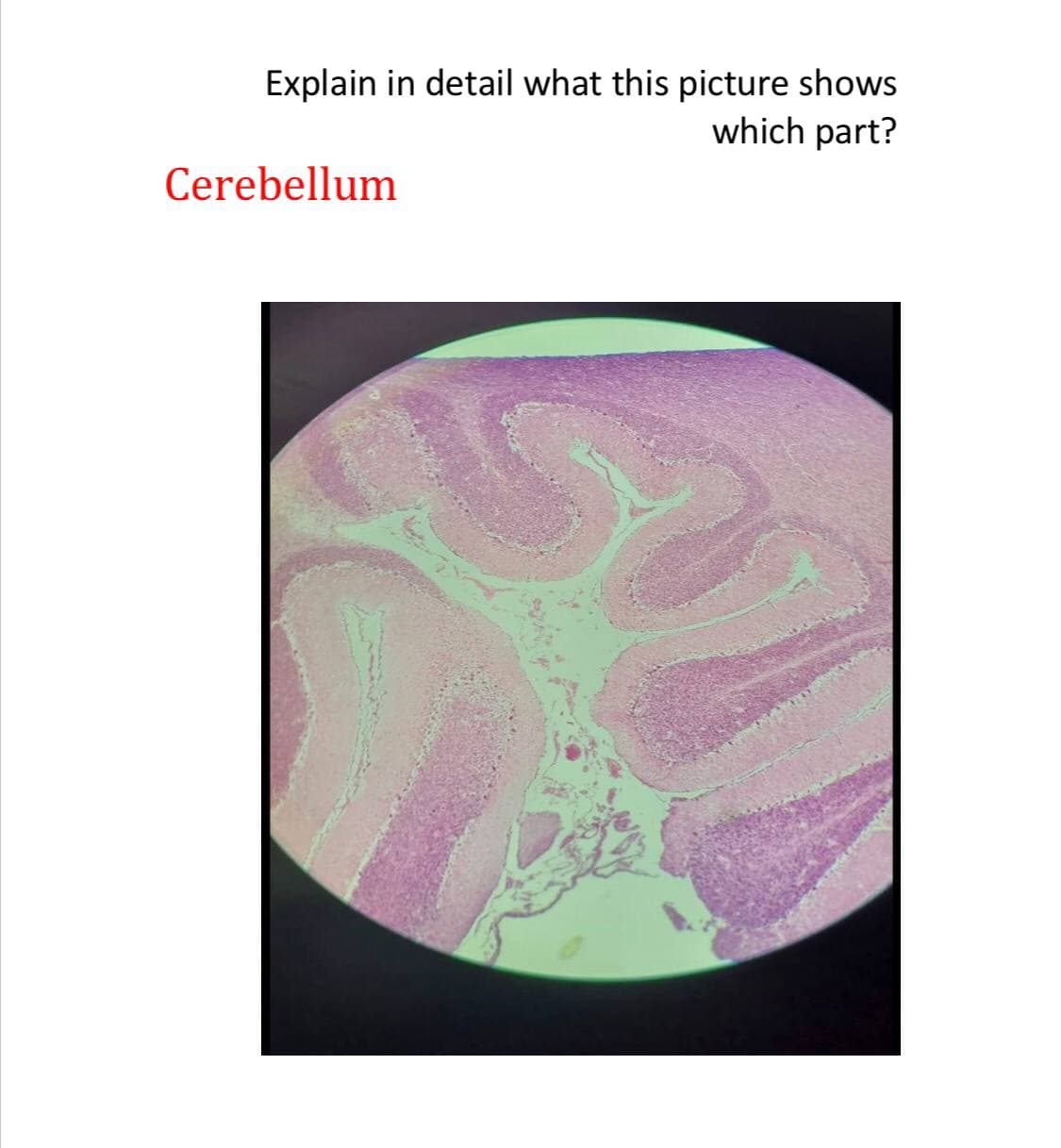 Explain in detail what this picture shows
which part?
Cerebellum
