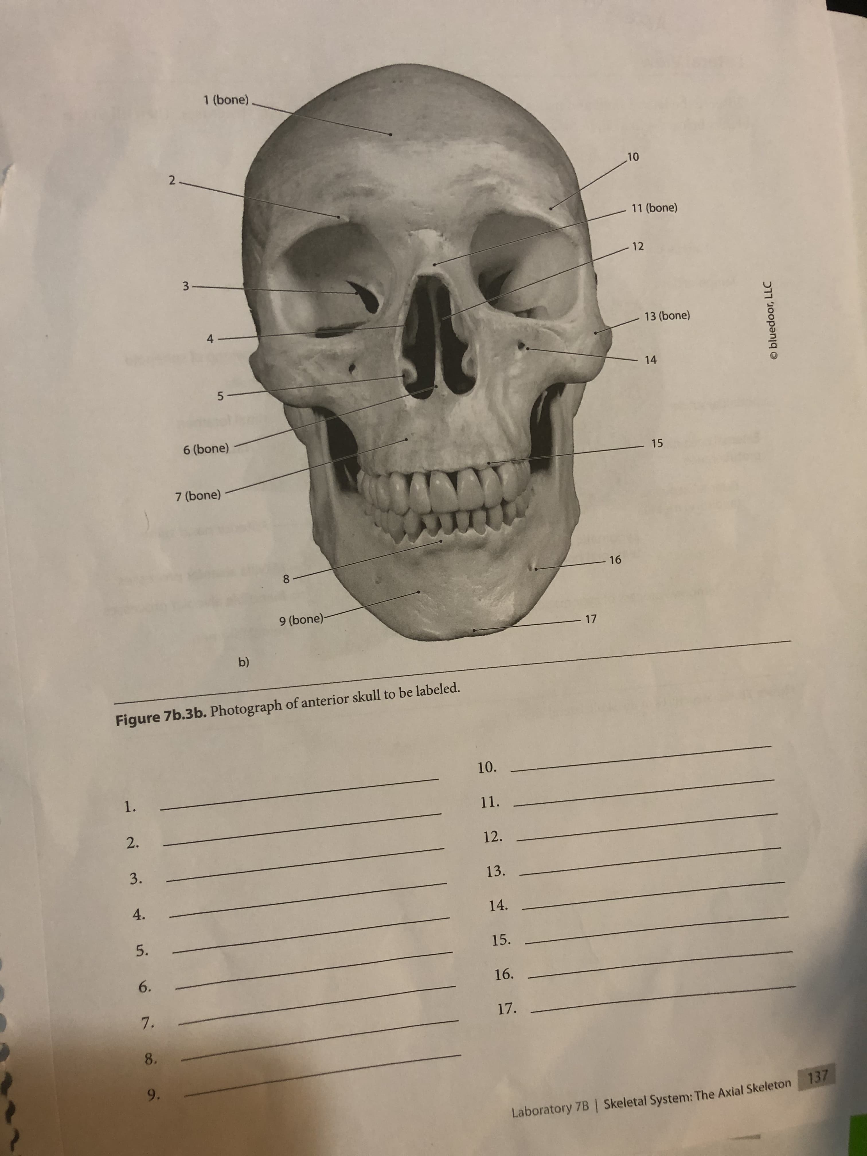 1 (bone)
2-
10
11 (bone)
12
4
13 (bone)
14
6 (bone)
15
7 (bone)
8.
- 16
9 (bone)-
-17
b)
Figure 7b.3b. Photograph of anterior skull to be labeled.
10.
1.
11.
2.
12.
3.
13.
4.
14.
5.
15.
6.
16.
7.
17.
8.
9.
137
Laboratory 7B Skeletal System: The Axial Skeleton
O bluedoor, LLC
5.
3.
