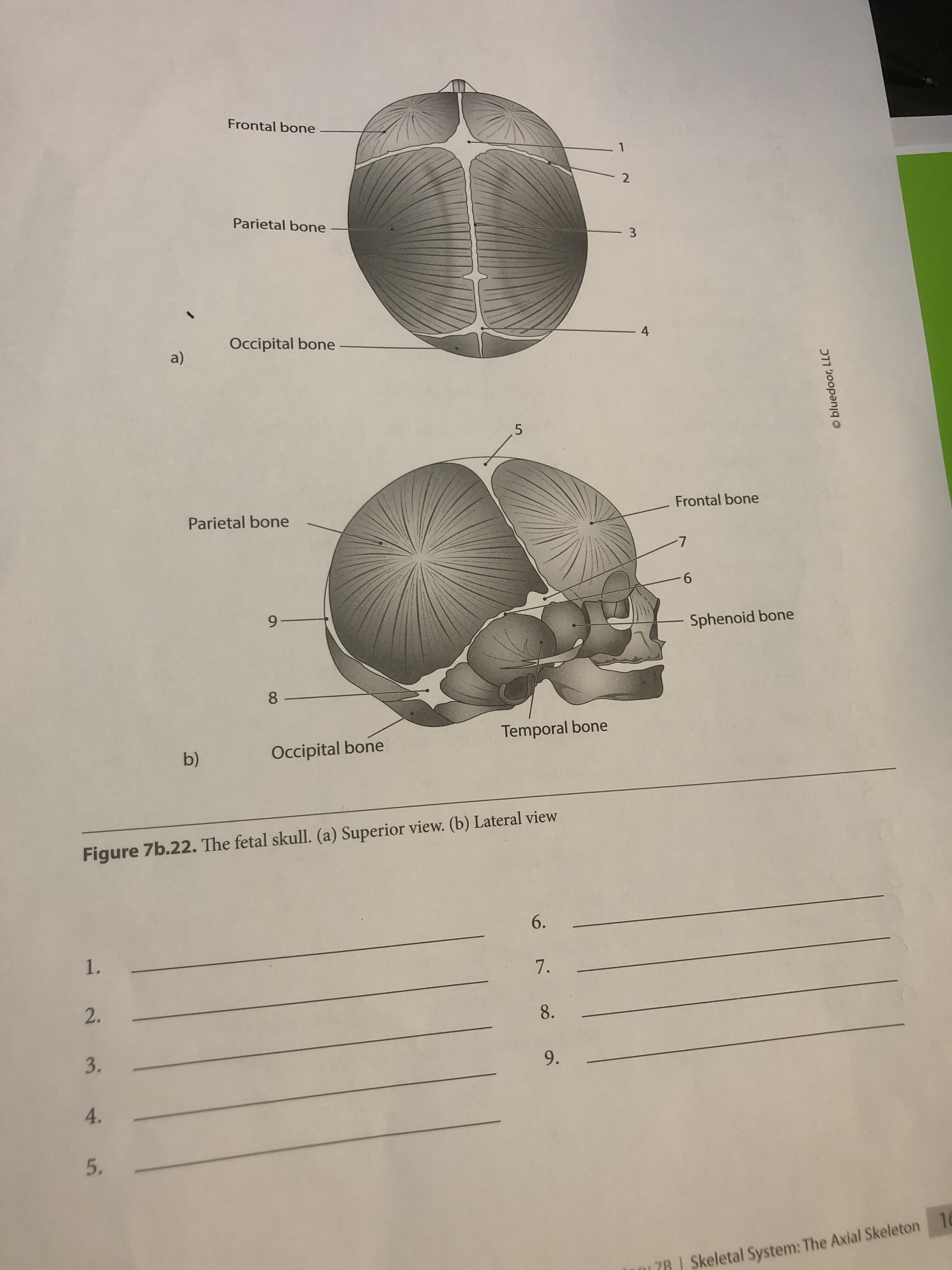 Frontal bone
Parietal bone
3
Occipital bone
4
a)
Parietal bone
Frontal bone
9.
9-
Sphenoid bone
8.
Temporal bone
b)
Occipital bone
Figure 7b.22. The fetal skull. (a) Superior view. (b) Lateral view
6.
1.
7. -
2.
8.
3.
9.
4.
7R | Skeletal System: The Axial Skeleton 16
5.
O bluedoor, LLC
