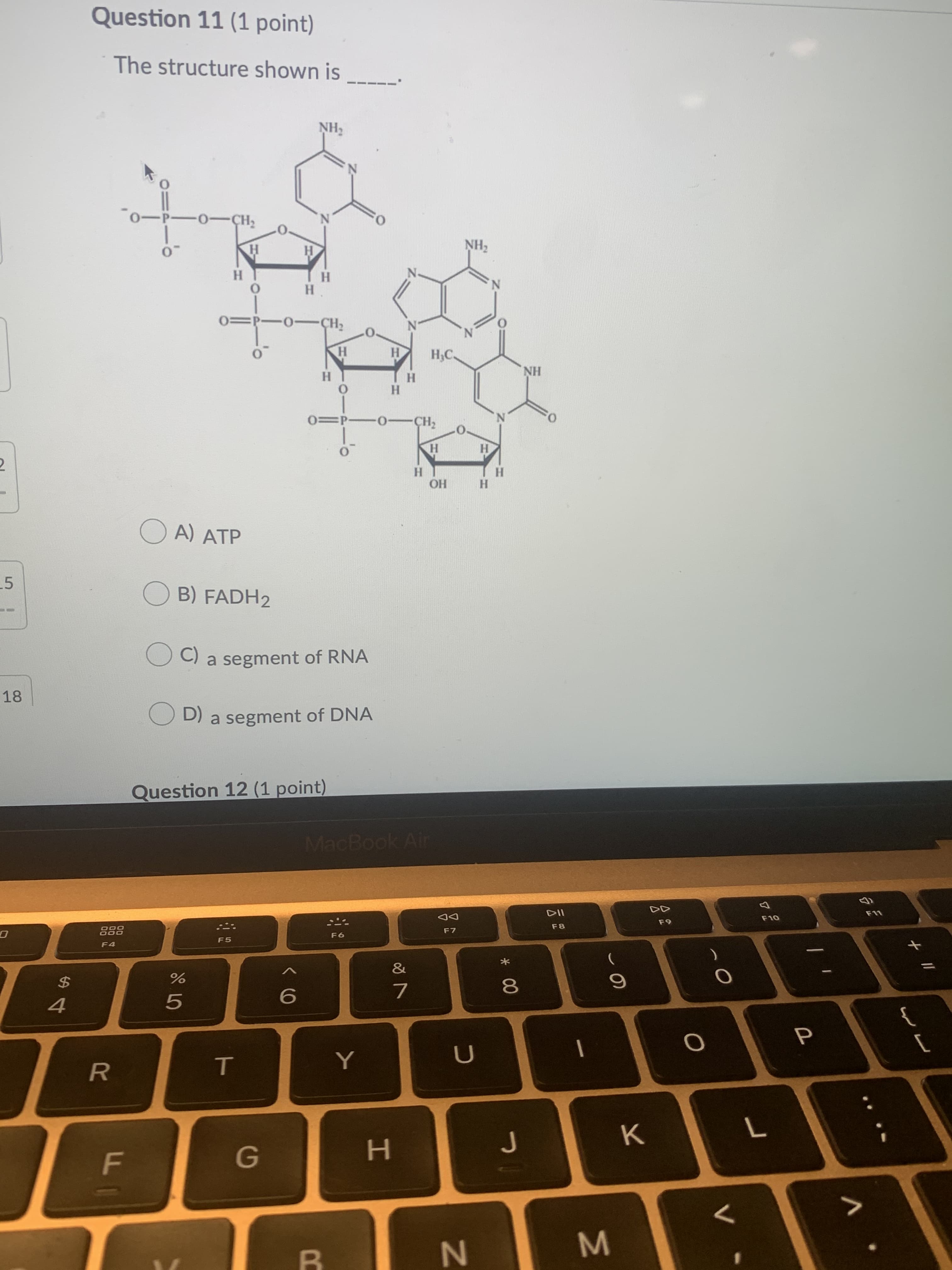 Question 11 (1 point)
The structure shown is
NH2
0-P-0- CH2
O:
H.
H
NH2
H.
N.
H
0=P-0 -CH2
O.
N.
H.
H
H;C.
H.
H.
NH
