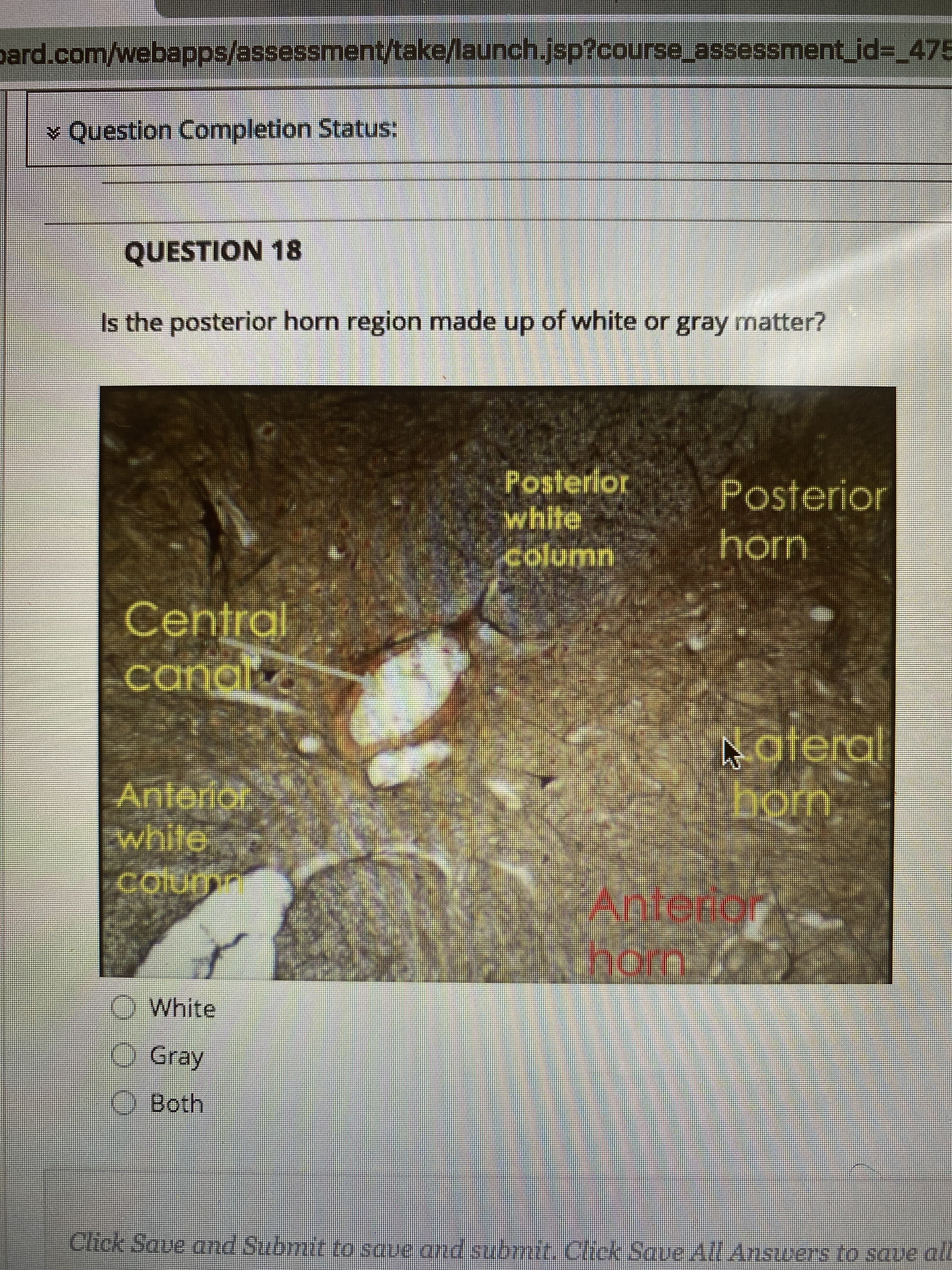 Is the posterior horn region made up of white or gray matter?
