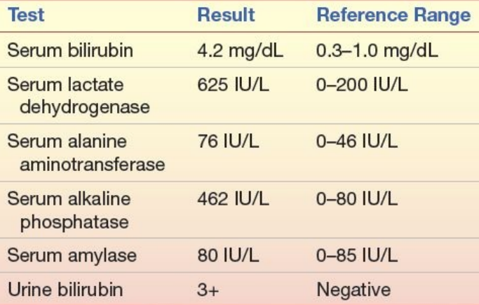 Test
Result
Reference Range
Serum bilirubin
4.2 mg/dL
0.3-1.0 mg/dL
Serum lactate
625 IU/L
0-200 IU/L
dehydrogenase
Serum alanine
aminotransferase
76 IU/L
0-46 IU/L
Serum alkaline
462 IU/L
0-80 IU/L
phosphatase
Serum amylase
80 IU/L
0-85 IU/L
Urine bilirubin
3+
Negative
