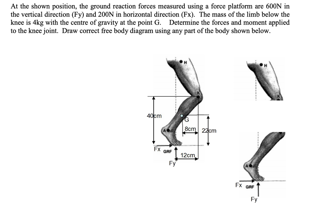 At the shown position, the ground reaction forces measured using a force platform are 600N in
the vertical direction (Fy) and 200N in horizontal direction (Fx). The mass of the limb below the
knee is 4kg with the centre of gravity at the point G. Determine the forces and moment applied
to the knee joint. Draw correct free body diagram using any part of the body shown below.
40cm
Fx
GRF
Fy
G
8cm
12cm
22cm
Fx GRF
Fy