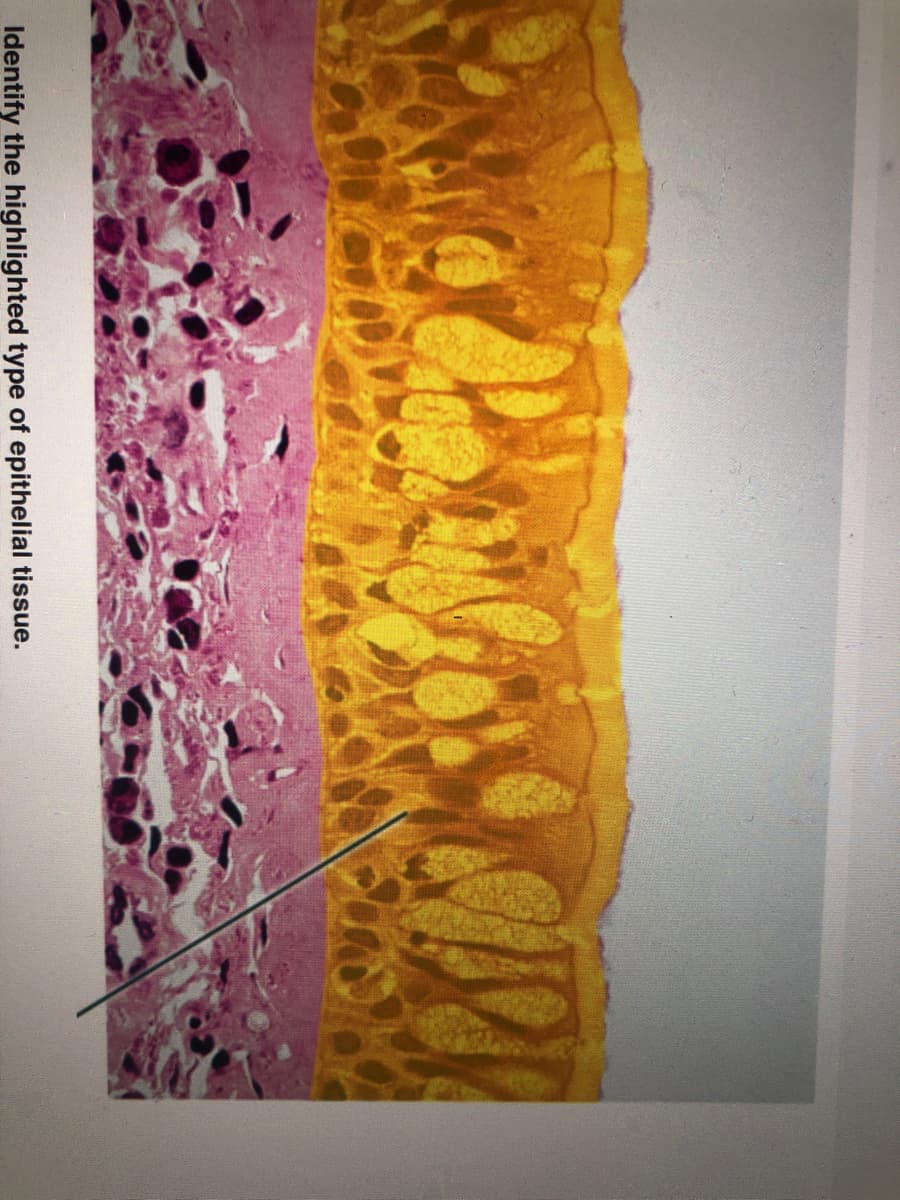 Identify the highlighted type of epithelial tissue.
Pens