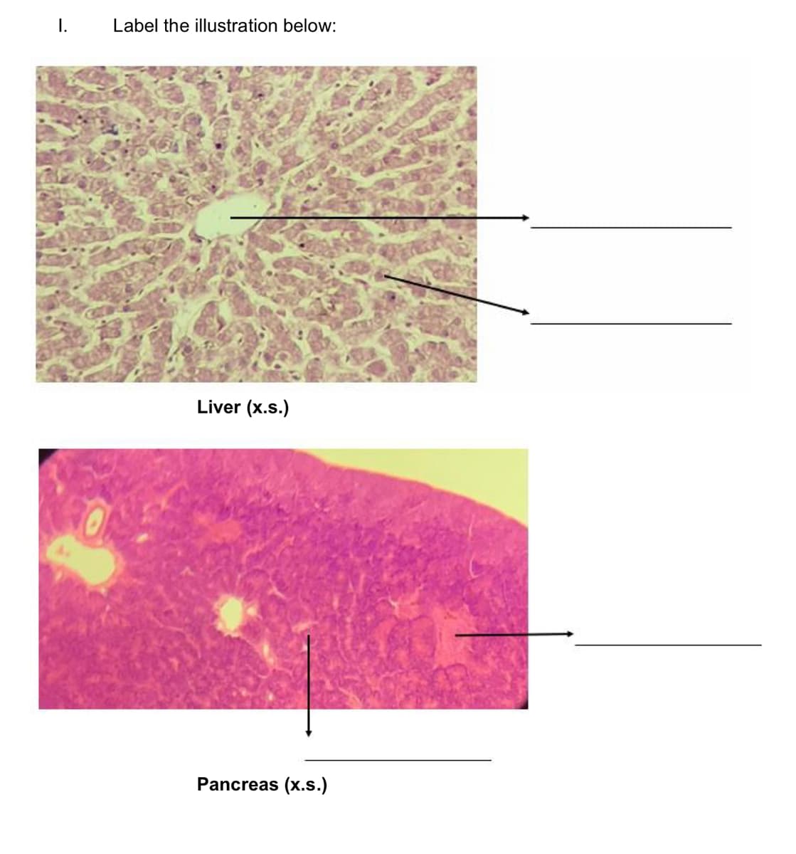 Label the illustration below:
Liver (x.s.)
Pancreas (x.s.)
