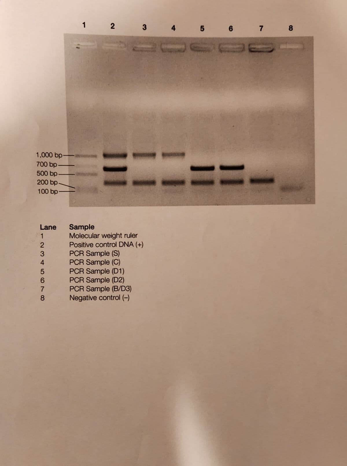 1,000 bp-
700 bp.
500 bp
200 bp.
100 bp-
Lane
12345678
6
8
Sample
Molecular weight ruler
Positive control DNA (+)
PCR Sample (S)
PCR Sample (C)
PCR Sample (D1)
PCR Sample (D2)
PCR Sample (B/D3)
Negative control (-)
1 2
3
4 5 6 7 8
I
1
I I