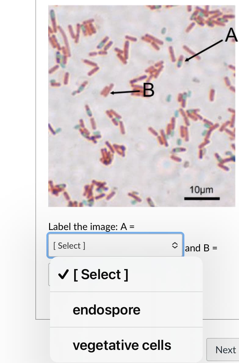 A
10μ
Label the image: A =
[ Select ]
and B:
V [ Select ]
endospore
vegetative cells
Next

