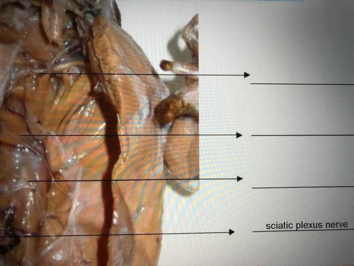 sciatic plexus nerve
