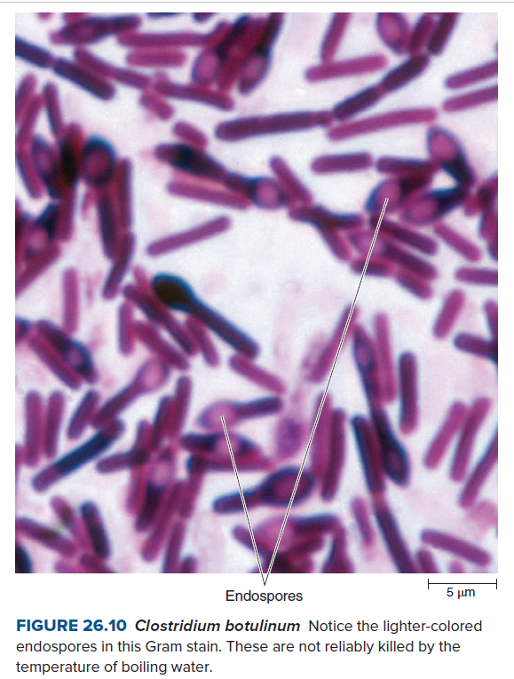 Endospores
5 µm
FIGURE 26.10 Clostridium botulinum Notice the lighter-colored
endospores in this Gram stain. These are not reliably killed by the
temperature of boiling water.

