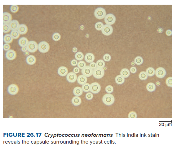 20 um
FIGURE 26.17 Cryptococcus neoformans This India ink stain
reveals the capsule surrounding the yeast cells.
