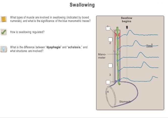 Swallowing
What types of muscle are involved in swallowing (indicated by boxed
numerais), and what is the significance of the blue manometric traces?
Swallow
begins
How is swallowing regulated?
Time
What is the difference between "dysphagia" and 'achalasia," and
what structures are involved?
Mano-
meter
Stomach
