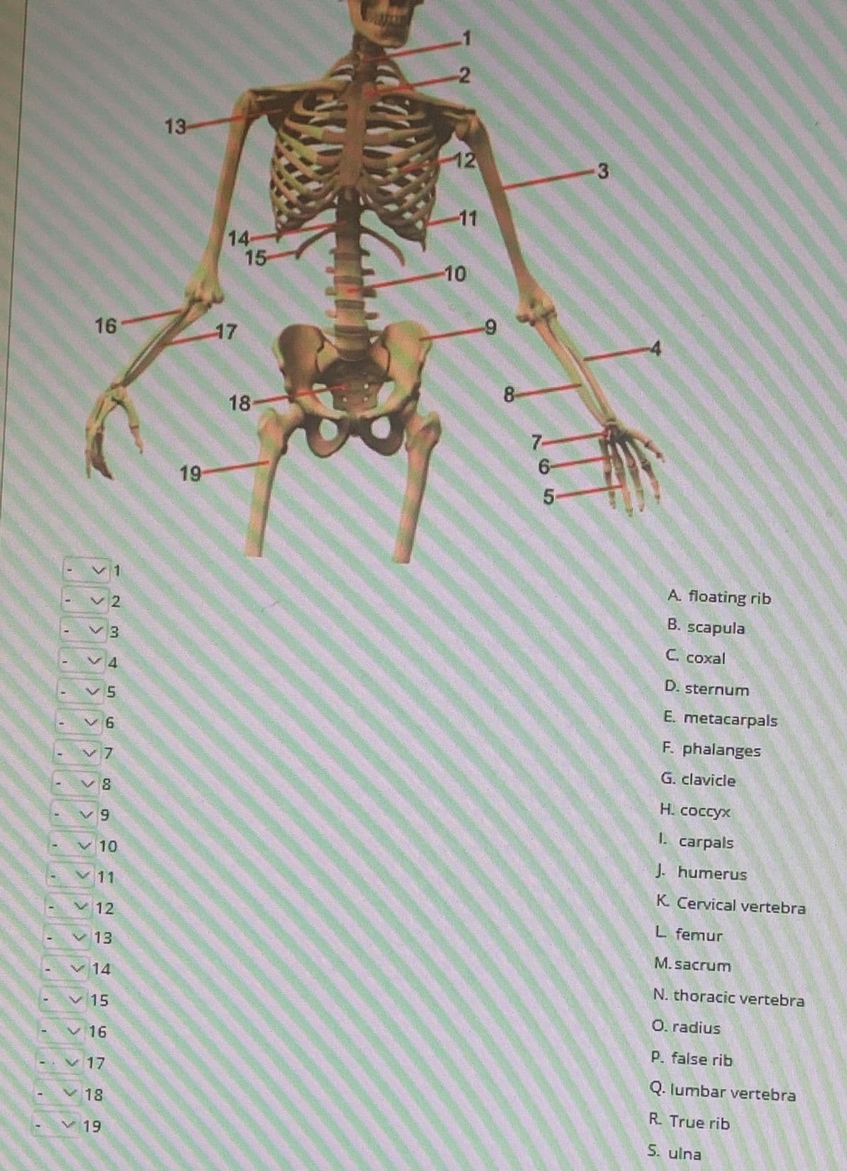 -2
13-
12
11
14
15
10
16
17
8-
18
7-
6-
19
A. floating rib
B. scapula
C. coxal
4.
D. sternum
E. metacarpals
F. phalanges
7
G. clavicle
H. coccyx
I. carpals
V10
J. humerus
11
K. Cervical vertebra
12
L femur
v13
M.sacrum
v 14
N. thoracic vertebra
v15
O. radius
v 16
P. false rib
v17
Q. lumbar vertebra
18
R. True rib
v 19
S. ulna
3.
23
