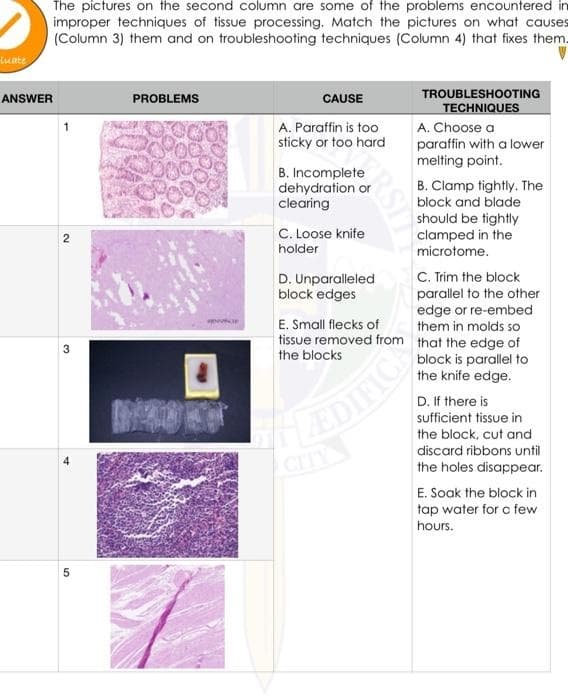 The pictures on the second column are some of the problems encountered in
improper techniques of tissue processing. Match the pictures on what causes
(Column 3) them and on troubleshooting techniques (Column 4) that fixes them.
Luate
TROUBLESHOOTING
ANSWER
PROBLEMS
CAUSE
TECHNIQUES
A. Paraffin is too
sticky or too hard
A. Choose a
paraffin with a lower
melting point.
B. Incomplete
dehydration or
clearing
B. Clamp tightly. The
block and blade
C. Loose knife
should be tightly
clamped in the
holder
microtome.
C. Trim the block
parallel to the other
edge or re-embed
them in molds so
tissue removed from that the edge of
D. Unparalleled
block edges
E. Small flecks of
the blocks
block is parallel to
the knife edge.
D. If there is
sufficient tissue in
EDIFICA
the block, cut and
discard ribbons until
CITY
the holes disappear.
E. Soak the block in
tap water for a few
hours.
5
RST
2.
