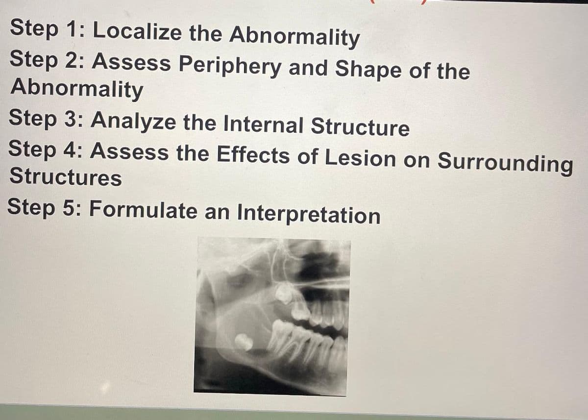 Step 1: Localize the Abnormality
Step 2: Assess Periphery and Shape of the
Abnormality
Step 3: Analyze the Internal Structure
Step 4: Assess the Effects of Lesion on Surrounding
Structures
Step 5: Formulate an Interpretation
