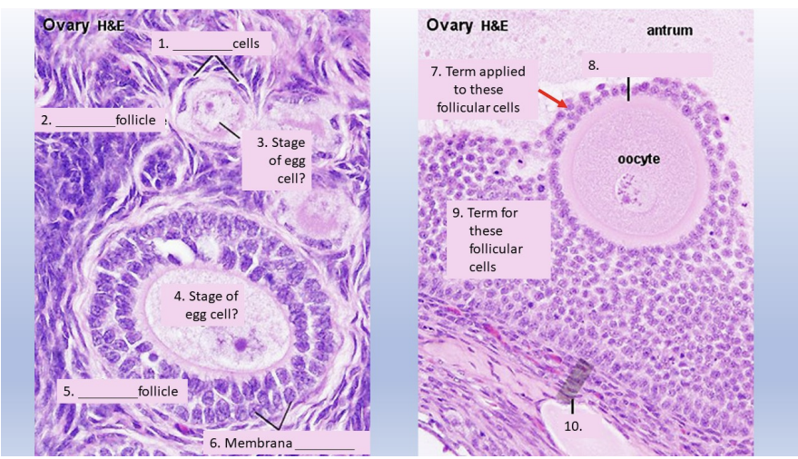 Ovary H&E
2.
5.
_follicle
1.
_cells
4. Stage of
egg cell?
_follicle
3. Stage
of egg
cell?
6. Membrana
ASD TE
Ovary H&E
7. Term applied
to these
follicular cells
9. Term for
these
follicular
cells
10.
8.
antrum
oocyte
