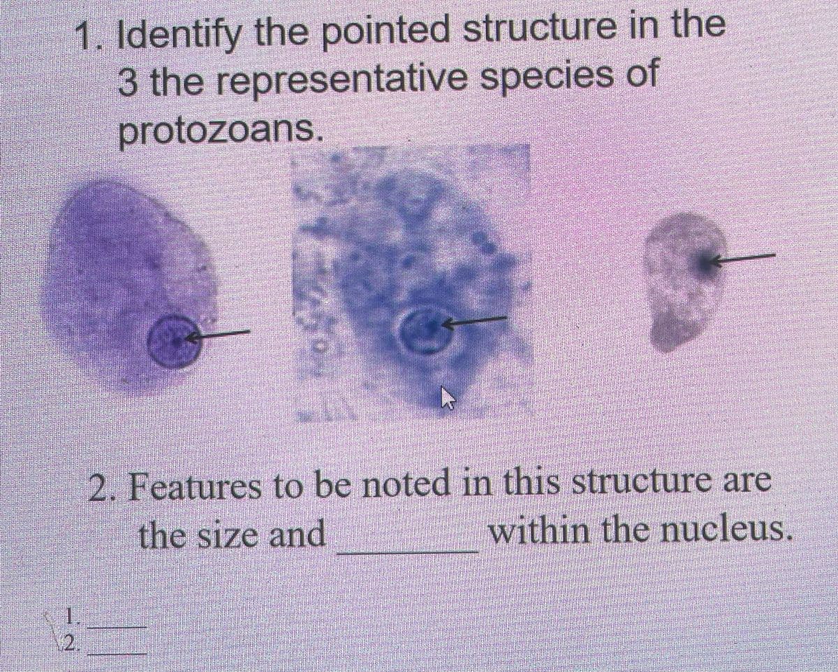 1. Identify the pointed structure in the
3 the representative species of
protozoans.
132
C
2. Features to be noted in this structure are
the size and
within the nucleus.