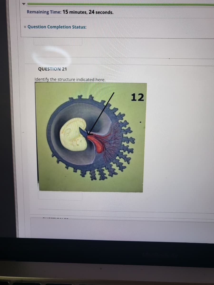 Remaining Time: 15 minutes, 24 seconds.
Question Completion Status:
QUESTION 21
Identify the structure indicated here.
12