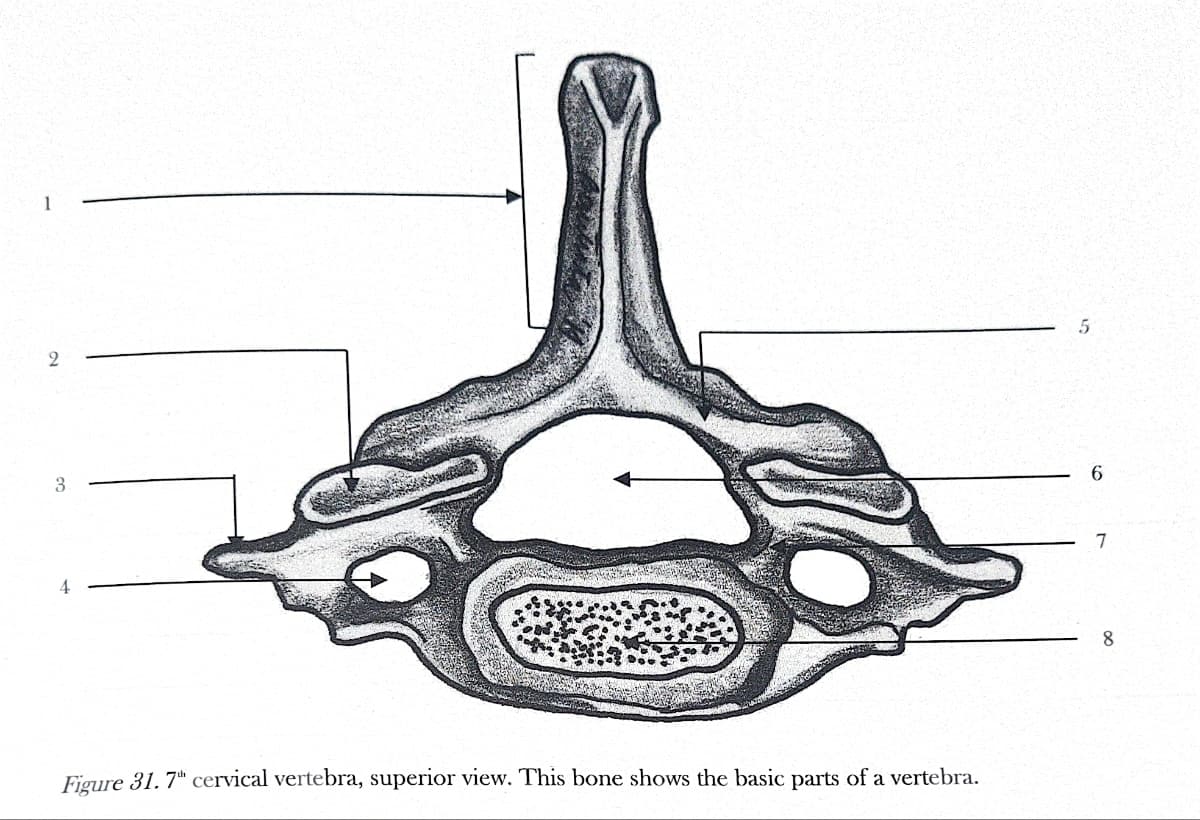 2
3
4
Figure 31.7th cervical vertebra, superior view. This bone shows the basic parts of a vertebra.
5
6
7
8
