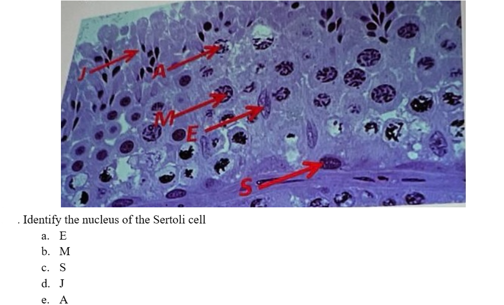 . Identify the nucleus of the Sertoli cell
a.
E
b. M
c. S
d. J
e. A
