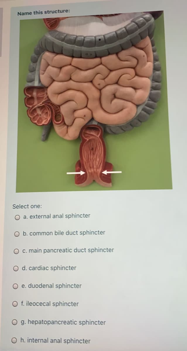 Name this structure:
Select one:
O a. external anal sphincter
O b. common bile duct sphincter
O c. main pancreatic duct sphincter
O d. cardiac sphincter
O e. duodenal sphincter
O f. ileocecal sphincter
O g. hepatopancreatic sphincter
O h. internal anal sphincter
