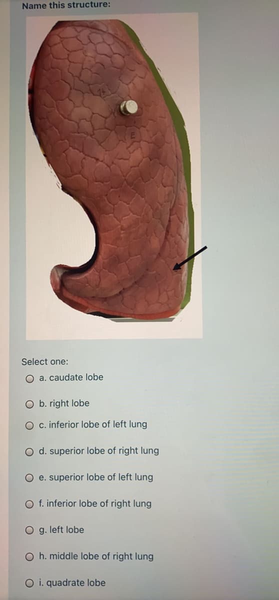 Name this structure:
Select one:
O a. caudate lobe
O b. right lobe
O c. inferior lobe of left lung
O d. superior lobe of right lung
O e. superior lobe of left lung
O f. inferior lobe of right lung
O g. left lobe
O h. middle lobe of right lung
O i. quadrate lobe
