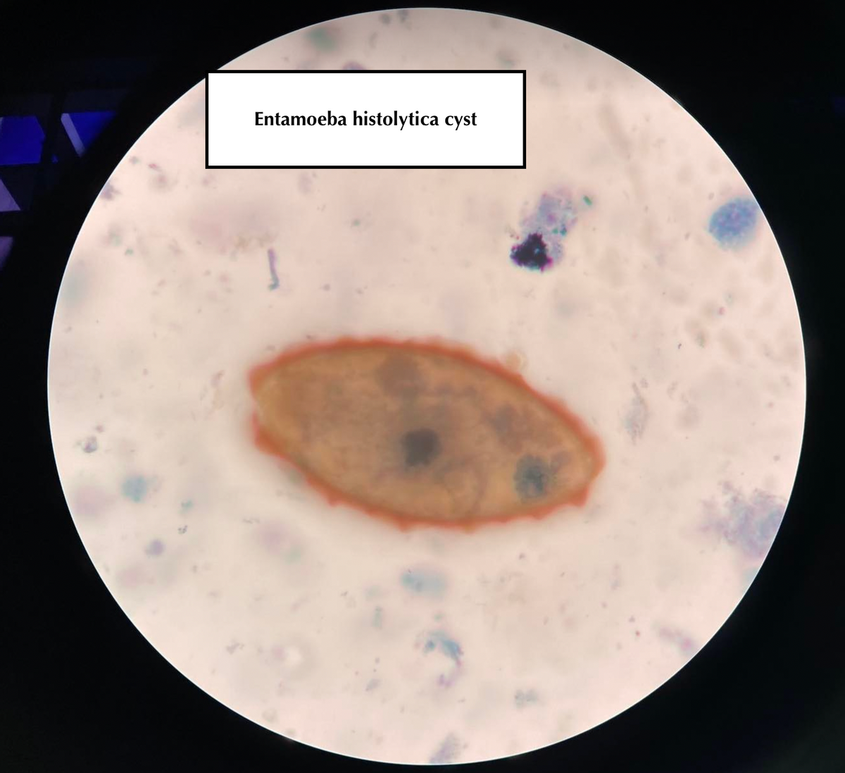 Entamoeba histolytica cyst