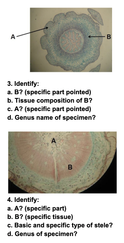 A
3. Identify:
a. B? (specific part pointed)
b. Tissue composition of B?
c. A? (specific part pointed)
d. Genus name of specimen?
4. Identify:
a. A? (specific part)
b. B? (specific tissue)
c. Basic and specific type of stele?
d. Genus of specimen?
