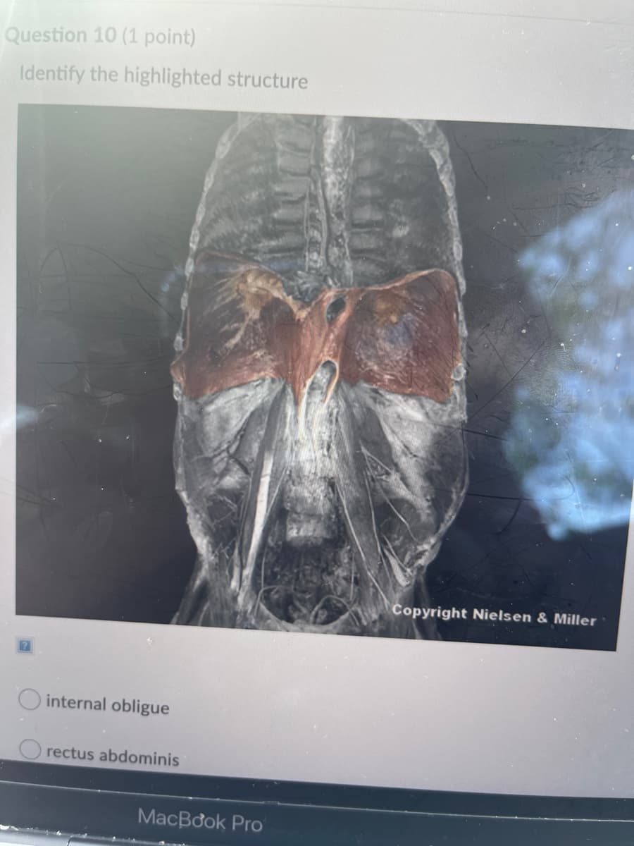 Question 10 (1 point)
Identify the highlighted structure
Copyright Nielsen & Miller
O internal obligue
O rectus abdominis
MacBook Pro
