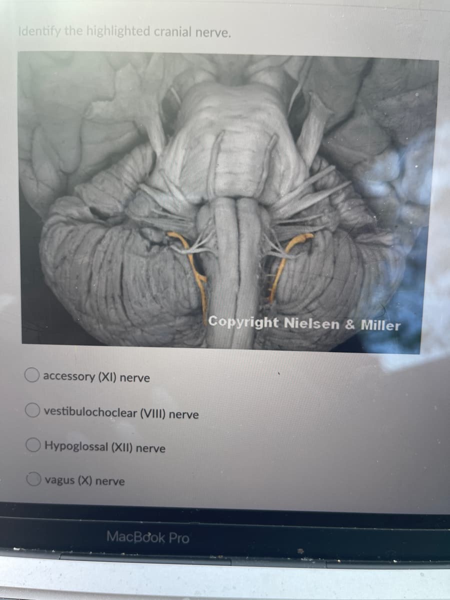 Identify the highlighted cranial nerve.
Copyright Nielsen & Miller
accessory (XI) nerve
vestibulochoclear (VIII) nerve
Hypoglossal (XII) nerve
vagus (X) nerve
MacBook Pro
