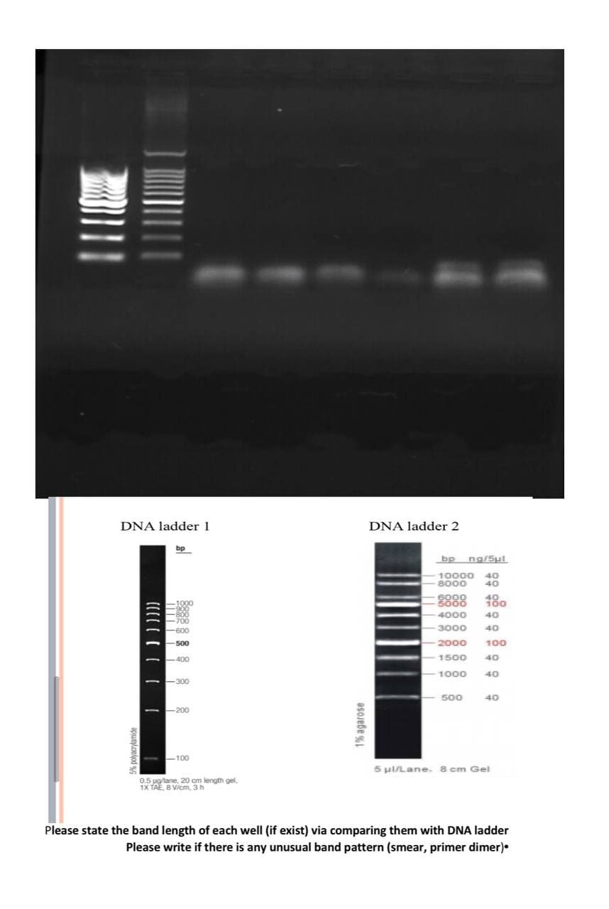 DNA ladder 1
DNA ladder 2
bp
bp ng/Sul
10000 40
8000
40
8888
180
4000
40
-600
3000
40
500
2000
100
1500
40
1000
40
500
40
200
100
5 HILane. 8 cm Gel
0.5 ug/lane, 20 cm length gel,
1X TAE, B V/cm, 3h
Please state the band length of each well (if exist) via comparing them with DNA ladder
Please write if there is any unusual band pattern (smear, primer dimer).
1% agarose
