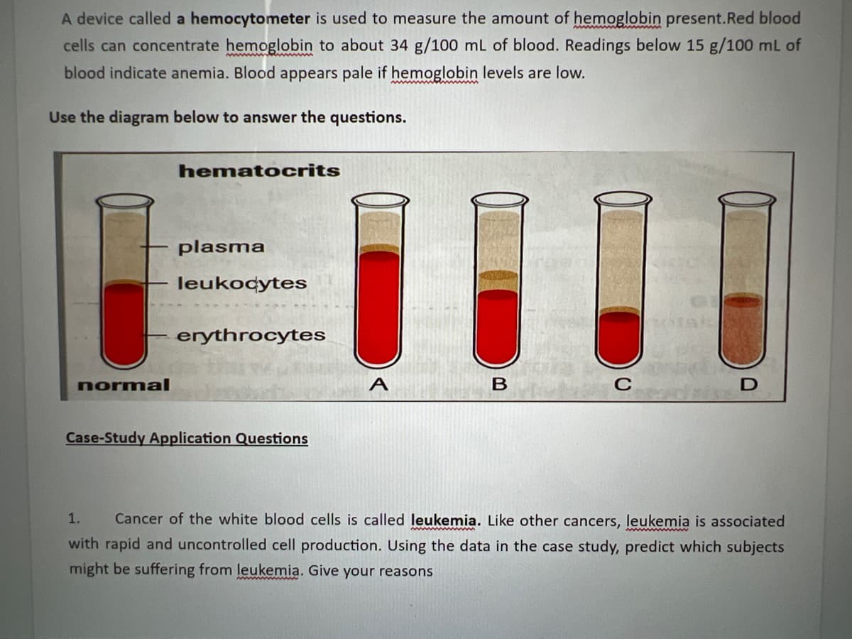A device called a hemocytometer is used to measure the amount of hemoglobin present.Red blood
cells can concentrate hemoglobin to about 34 g/100 mL of blood. Readings below 15 g/100 mL of
blood indicate anemia. Blood appears pale if hemoglobin levels are low.
Use the diagram below to answer the questions.
hematocrits
plasma
leukocytes
11
erythrocytes
normal
A
B
C
D
Case-Study Application Questions
1. Cancer of the white blood cells is called leukemia. Like other cancers, leukemia is associated
with rapid and uncontrolled cell production. Using the data in the case study, predict which subjects
might be suffering from leukemia. Give your reasons