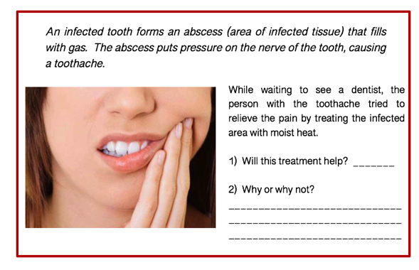 An infected tooth forms an abscess (area of infected tissue) that fills
with gas. The abscess puts pressure on the nerve of the tooth, causing
a toothache.
While waiting to see a dentist, the
person with the toothache tried to
relieve the pain by treating the infected
area with moist heat.
1) Will this treatment help?
2) Why or why not?
