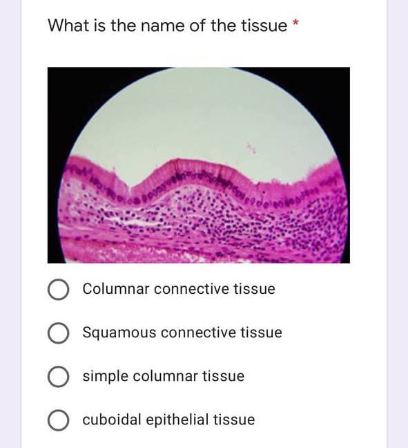 What is the name of the tissue *
Columnar connective tissue
Squamous connective tissue
simple columnar tissue
cuboidal epithelial tissue
