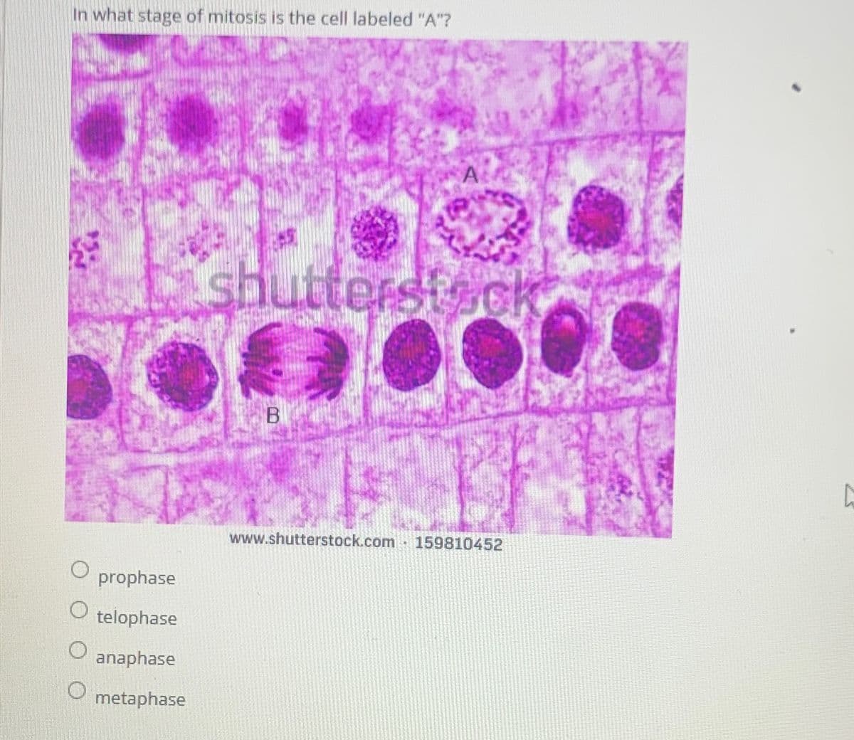 In what stage of mitosis is the cell labeled "A"?
A
shutterstock
B
www.shutterstock.com 159810452
O
prophase
O
telophase
anaphase
O
metaphase