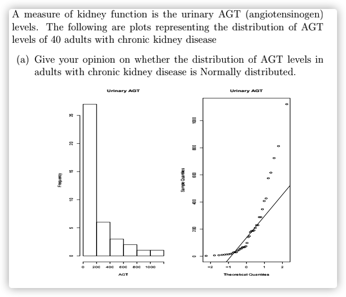 A measure of kidney function is the urinary AGT (angiotensinogen)
| levels. The following are plots representing the distribution of AGT
| levels of 40 adults with chronic kidney disease
(a) Give your opinion on whether the distribution of AGT levels in
adults with chronic kidney disease is Normally distributed.
Urinary AGT
Urinary AGT
200
400
coc
800
1000
-2
-1
AGT
TheoreticaI Quantiles
000
009
Sampe Quarties
icuerteu
